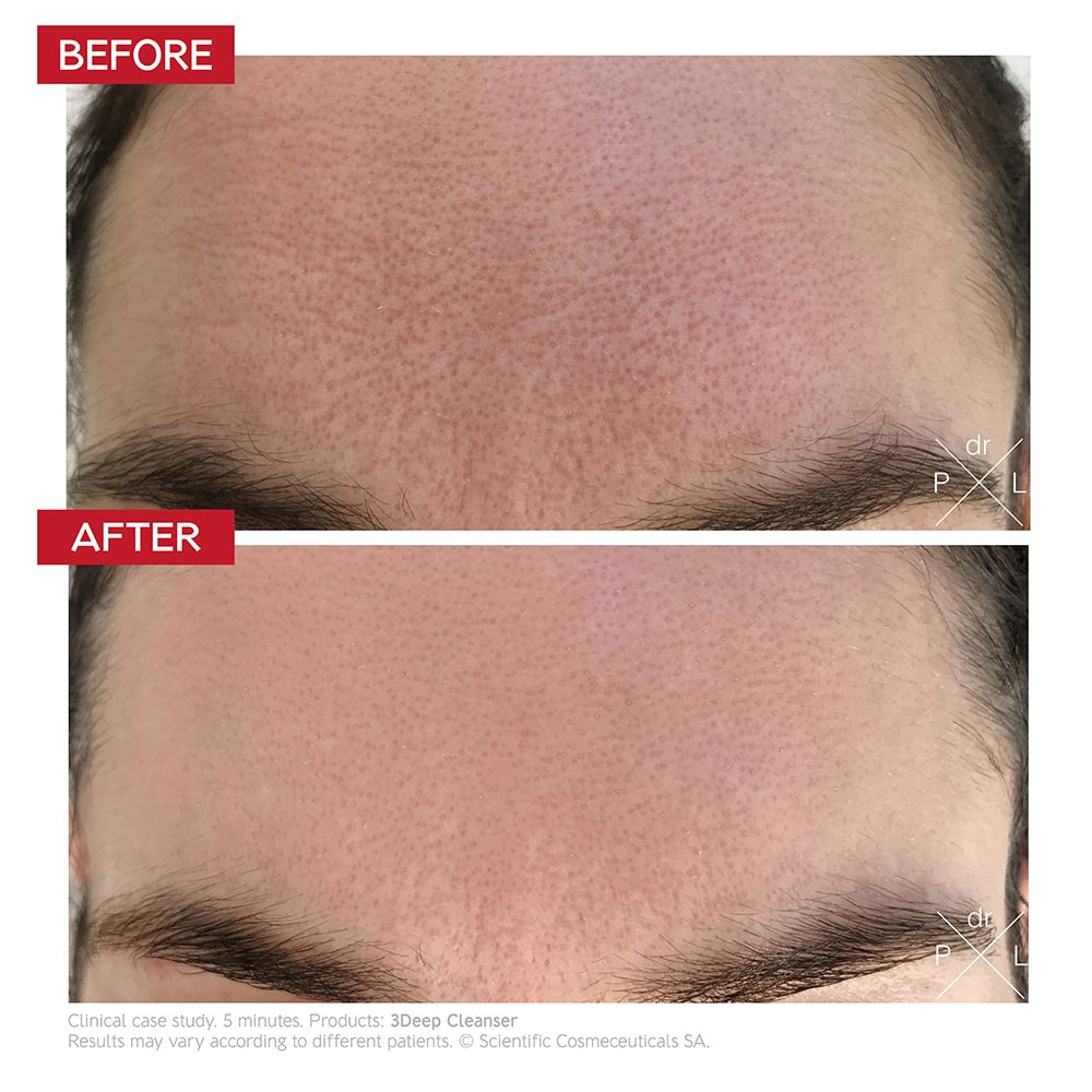 FastMask ritual – instant glow and renewal