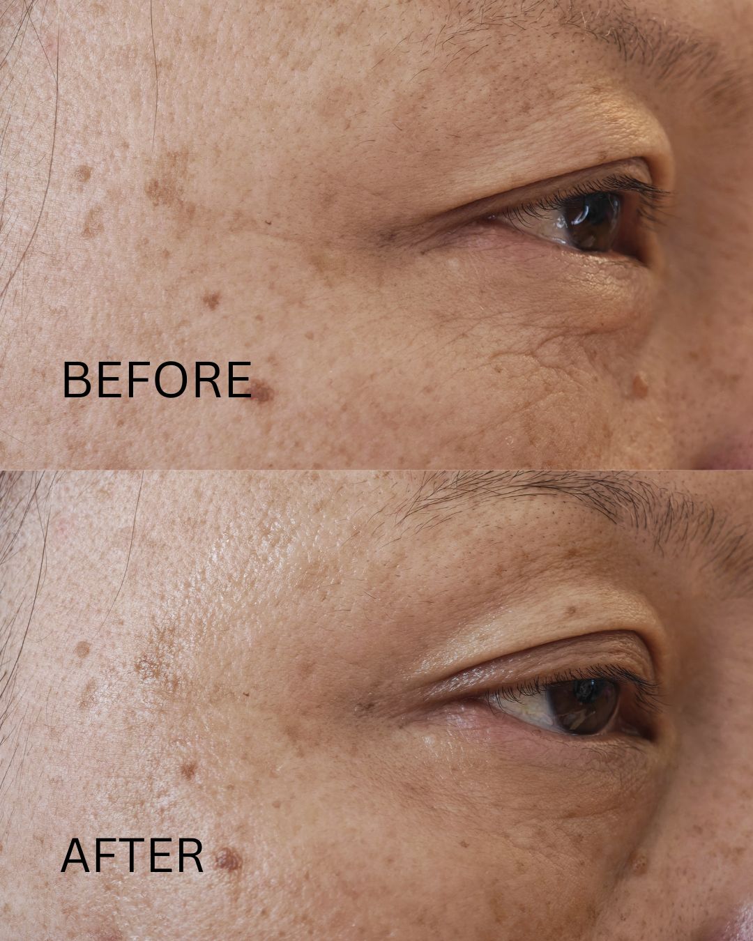 Dr levy The Contour Pro
