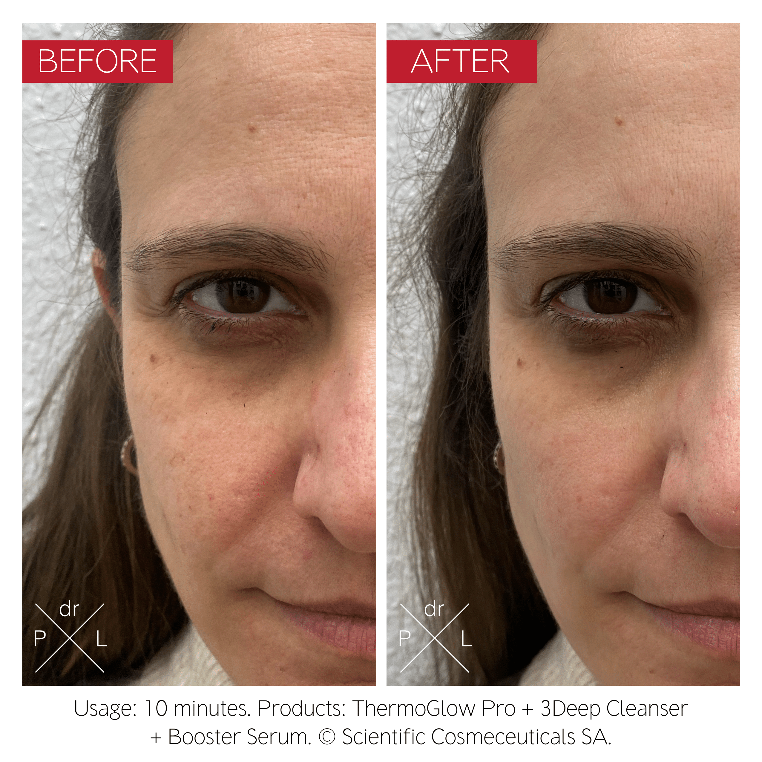 ThermoGlow Pro device with Freezing Anti-Fatigue Mask and 3Deep Cleanser