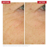 Dr Levy intense stem cell booster cream 50 ml